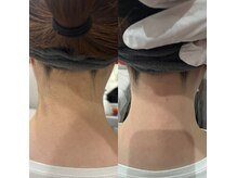 メリア 岡山駅前店(melia)/うなじWAX