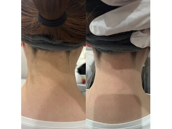 メリア 岡山駅前店(melia)/うなじWAX