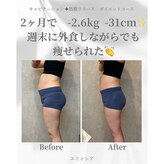 エミィシア(Emisia)