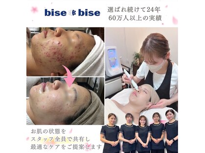 ビズビズ 梅田店(bisebise)の写真