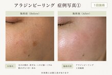 リシェリ 代官山(RICHERI)