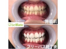ルブラン 奈良店(Le Blanc)/白ってなんでも清潔に見えます
