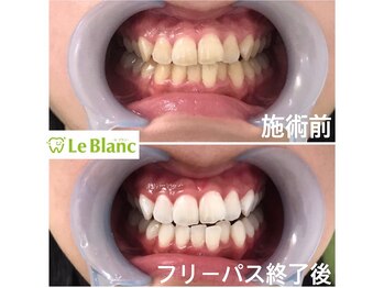 ルブラン 奈良店(Le Blanc)/白ってなんでも清潔に見えます