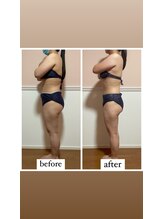 トータル フィルシャイン(Total Fillshine)/痩身コース☆