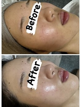 アネラ(ANELA)/クリスティーナ　アンストレス