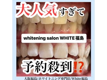 ホワイトニングサロン ホワイト(WHITE)/セルフホワイトニング/大阪/福島