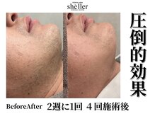 シェリエ(Sheller)