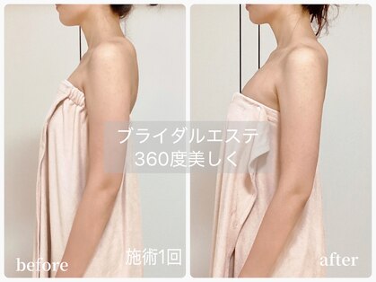 ビュー(Beau)の写真