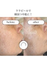 ユヌランコント 岐阜店(Une rencontre)/ララピール