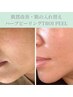 トロイアルケ【TROIピール】エイジングケア/リフトアップ特化◎