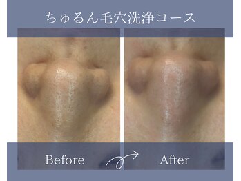 サロンドボーテアリス (Salon de beaute ALICE)/ごっそり毛穴洗浄!