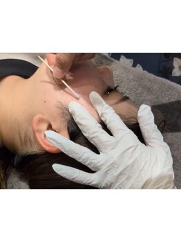 シミしわ改善！予防ケア