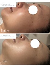 サンラックスサロン 岐阜(SANlux Salon)/美白★イラストリアス