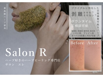 アール(R)の写真