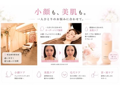 小顔美肌ファクトリー 梅田院の写真
