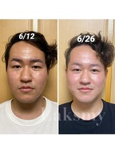 ラクシュミー ナチュラル(Laksmy NATURAL)/お客様ビフォーアフター