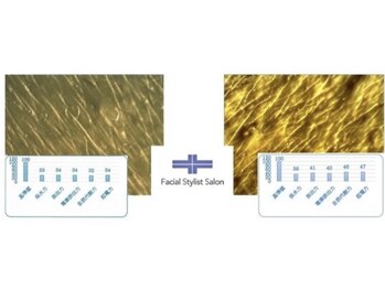 フェイシャルスタイリストサロン 四谷店/ケア例(59)