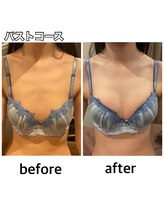 エステティックレイビス 名古屋店(RAYVIS)/予約殺到！バストケア