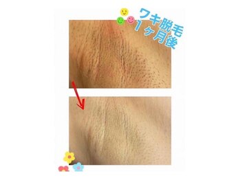 アネル 浦添店(anel)/