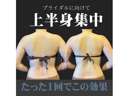 ザ スリム スパ リュクス(THE Slim Spa LUEX)の写真