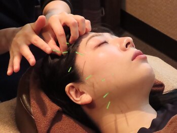 きわみ鍼灸整骨院 博多院/【博多駅】頭痛や眼精疲労に