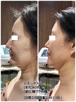 クレビア 神保町 水道橋(CREBIA)/レモンボトル