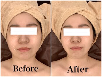 スペチアーレ 夙川/劇的小顔に