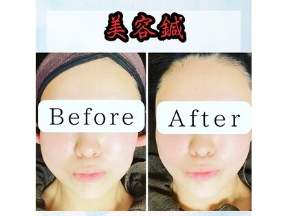 フィエール(fier)の写真