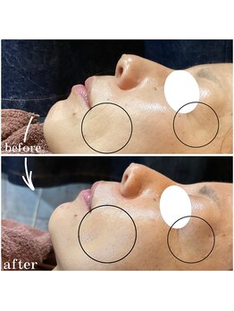 サロンドウルス(salon de ours)/エクソソーム