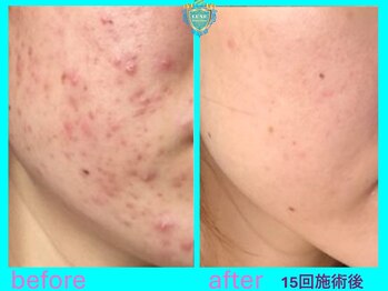 リュクス(LUXE)/ビフォーアフター