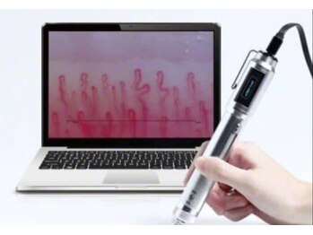 マルーカ 中目黒(MALUUCA)/毛細血管観察用マイクロスコープ