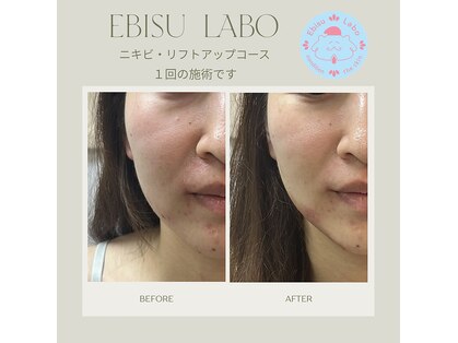 エビスラボ(Ebisu Labo)の写真