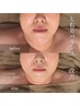 【リピート割】美肌小顔矯正フェイシャル★エラ張/左右差頬張/小顔調整/90分