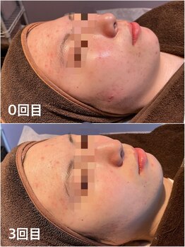 ケーナインエッセ(K9 esse)/ハーブピーリングBefore→After