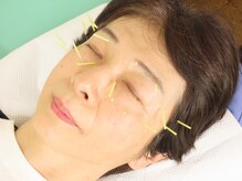 南花畑接骨・鍼灸マッサージ院