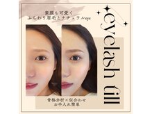 アイラッシュ ティル(eyelash till)