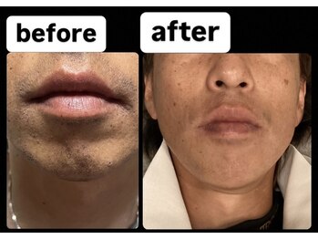 ゴッド(GOD)/ビフォーアフター