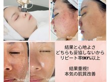 サラシック(salachic)/