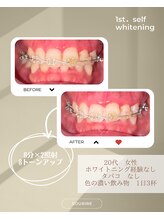 スリール(sourire)/ビフォーアフター