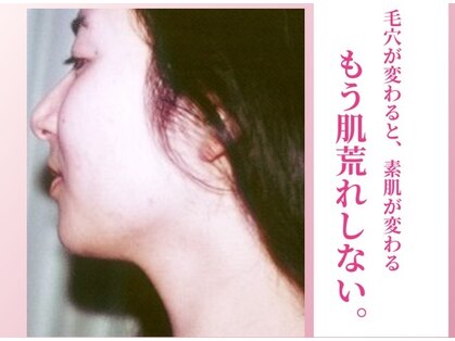 手づくり美顔サロン花 福岡天神本店の写真
