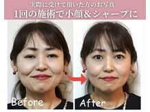 整体院ワト 三軒茶屋店(WATO)の雰囲気（【小顔・美容整体】一度で感動の変化を体験して下さい！）