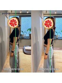 グレフル鍼灸接骨院 整体院 心斎橋/整体/肩こり/マッサージ/腰痛