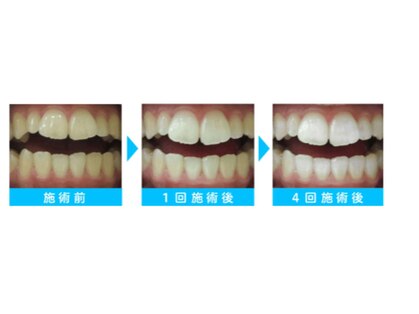 ヴィヴィ(ViVi)の写真