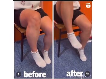 カワル整体 上通り院/股関節の違和感