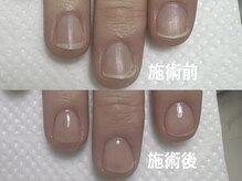 アメジスト(Amethyst)/自爪育成で爪の形を整える！