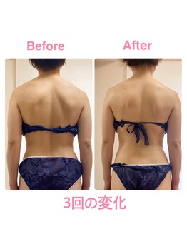 ペルラ(Perla)/お客様ビフォーアフター