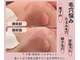 ベルガモットの写真/皮脂分泌倍増で毛穴汚れが気になる方へ!開き毛穴や黒ずみ毛穴を優しく整える特別なエステ◎
