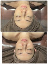 ベルフルール 西18丁目店/陶肌トリートメント＋コルギ