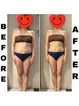 ヘルバ(HERBA)/痩身