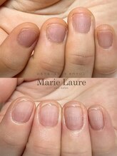 マリーロール 淀屋橋本店(Marie Laure)/自爪育成/深爪矯正/ネイルケア